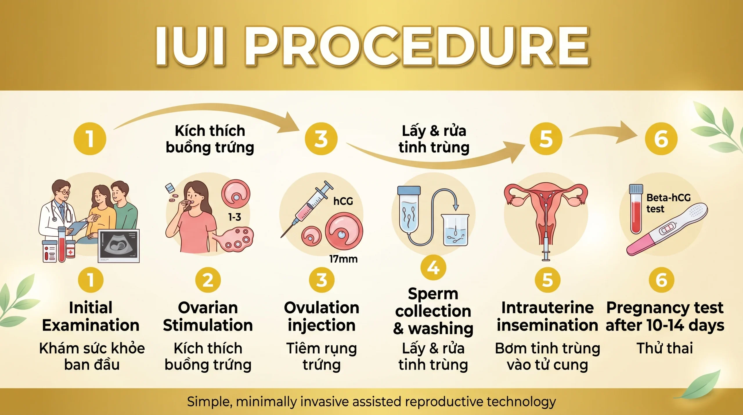 Quy-Trinh-thuc-hien-IUI